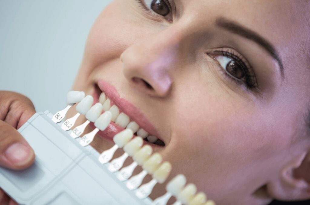 Woman's smile with teeth shade guide.